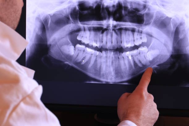 Best Emergency TMJ Treatment in Highpoint, OH